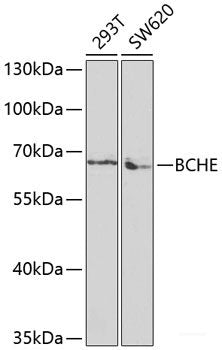 Immunohistochemistry of paraffin-embedded Rat testis using Polyclonal AntibodyPC1 Polyclonal Antibody at dilution of  1:100 (40x lens).