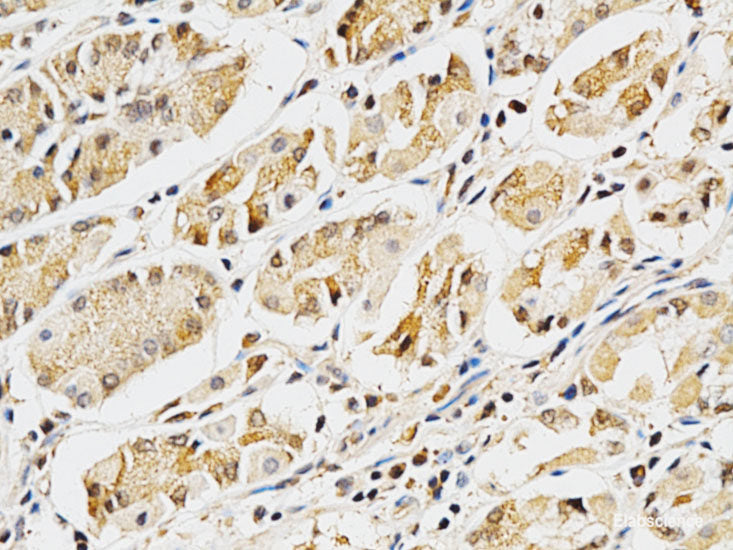 Immunohistochemistry of paraffin-embedded Rat brain using ZNF415 Polyclonal Antibody at dilution of  1:100 (40x lens).