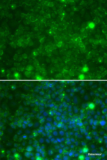 Immunofluorescence analysis of L929 cells using COL4A3BP Polyclonal Antibody at dilution of  1:100. Blue: DAPI for nuclear staining.