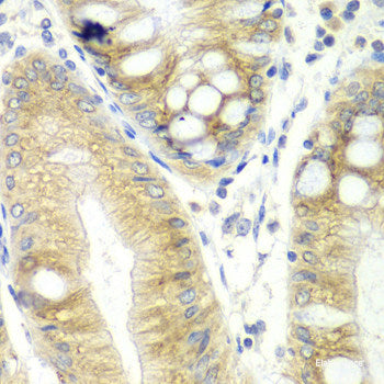 Immunofluorescence analysis of Mouse brain using RUSC1 Polyclonal Antibody at dilution of  1:100. Blue: DAPI for nuclear staining.