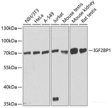 Immunofluorescence analysis of C6 cells using ARID1B Polyclonal Antibody at dilution of  1:100. Blue: DAPI for nuclear staining.