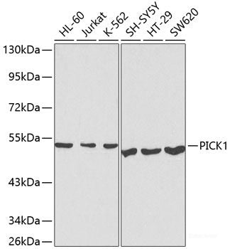 Immunofluorescence analysis of U-2 OS cells using LLPH Polyclonal Antibody at dilution of  1:100. Blue: DAPI for nuclear staining.