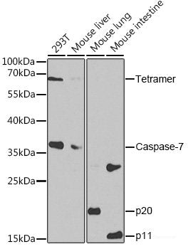 Immunohistochemistry of paraffin-embedded Rat lung using YTHDF2 Polyclonal Antibody at dilution of  1:100 (40x lens).