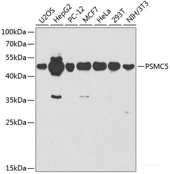 Immunofluorescence analysis of L929 cells using IL10RB Polyclonal Antibody at dilution of  1:100. Blue: DAPI for nuclear staining.