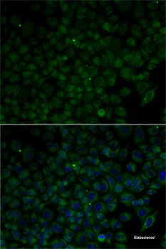 Immunofluorescence analysis of L929 cells using TBRG4 Polyclonal Antibody at dilution of  1:100. Blue: DAPI for nuclear staining.