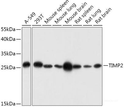 Immunofluorescence analysis of U-2 OS cells using SF3B1 Polyclonal Antibody at dilution of  1:100. Blue: DAPI for nuclear staining.
