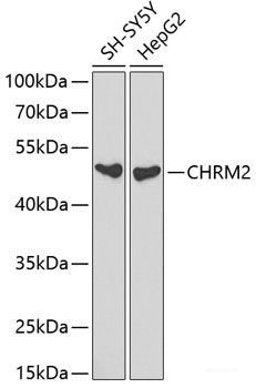 Immunofluorescence analysis of C6 cells using METTL16 Polyclonal Antibody at dilution of  1:100. Blue: DAPI for nuclear staining.
