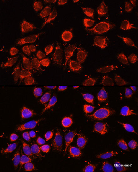 Immunohistochemistry of paraffin-embedded Human colon carcinoma using GPX2 Polyclonal Antibody at dilution of  1:100 (40x lens).