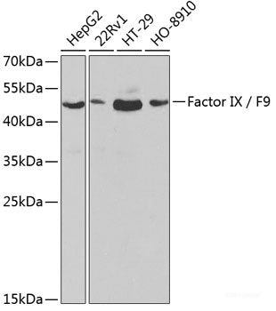 Immunofluorescence analysis of L929 cells using PTK2B Polyclonal Antibody at dilution of  1:100. Blue: DAPI for nuclear staining.