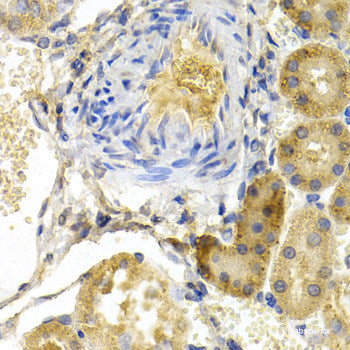 Immunohistochemistry of paraffin-embedded Mouse kidney using AQP2 Polyclonal Antibody at dilution of  1:100 (40x lens).