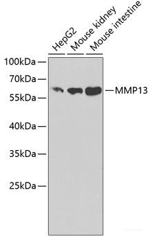 Immunohistochemistry of paraffin-embedded Rat kidney using FGD1 Polyclonal Antibody at dilution of  1:100 (40x lens).