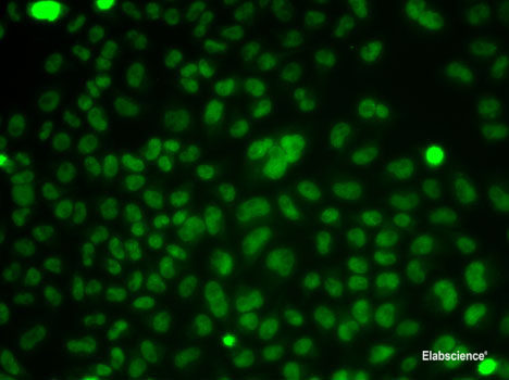Immunohistochemistry of paraffin-embedded Rat ovary using TIMP2 Polyclonal Antibody at dilution of  1:100 (40x lens).