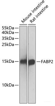 Immunofluorescence analysis of C6 cells using COMMD5 Polyclonal Antibody at dilution of  1:100. Blue: DAPI for nuclear staining.