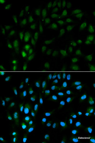 Immunohistochemistry of paraffin-embedded Rat brain using PTHLH Polyclonal Antibody at dilution of  1:200 (40x lens).