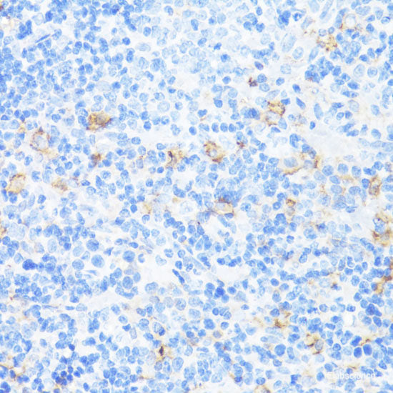 Immunofluorescence analysis of HepG2 cells (upper left) and LO2 cells (negative sample control) (upper right) using AFP Polyclonal Antibody at dilution of  1:100. Blue: DAPI for nuclear staining.