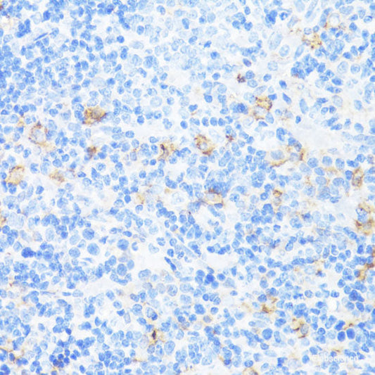 Immunofluorescence analysis of HepG2 cells (upper left) and LO2 cells (negative sample control) (upper right) using AFP Polyclonal Antibody at dilution of  1:100. Blue: DAPI for nuclear staining.