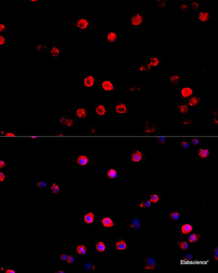 Immunohistochemistry of paraffin-embedded Rat liver using ASGR1 Polyclonal Antibody at dilution of  1:100 (40x lens).