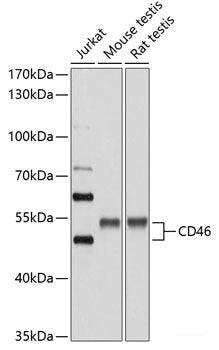 Immunohistochemistry of paraffin-embedded Human mammary cancer using FXN Polyclonal Antibody at dilution of  1:100 (40x lens).