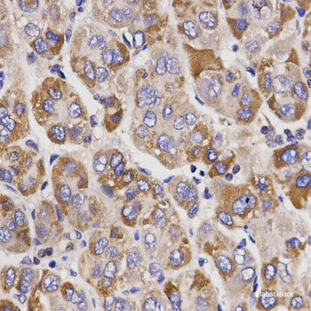 Immunofluorescence analysis of C6 cells using P70 S6K Polyclonal Antibody at dilution of  1:100. Blue: DAPI for nuclear staining.