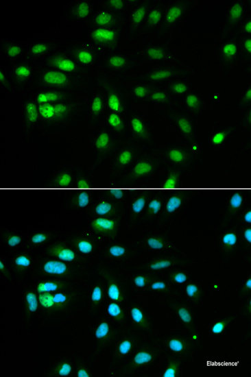 Immunohistochemistry of paraffin-embedded Human stomach using ARPC1A Polyclonal Antibody at dilution of  1:100 (40x lens).