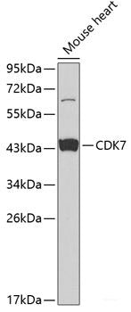 Immunohistochemistry of paraffin-embedded Human stomach using HDAC6 Polyclonal Antibody at dilution of  1:100 (40x lens).