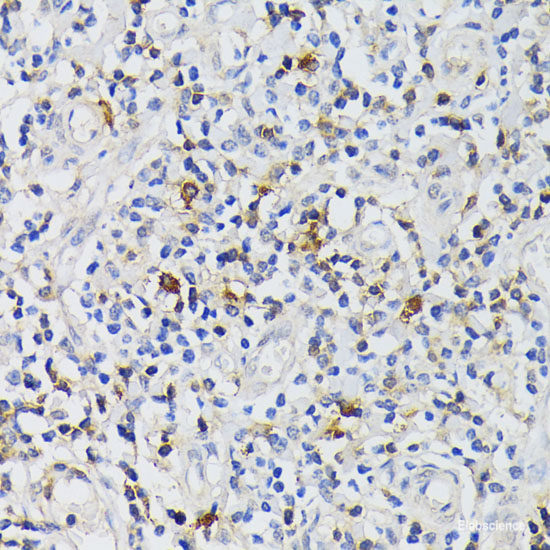 Immunofluorescence analysis of HeLa cells using ACADM Polyclonal Antibody at dilution of  1:100 (40x lens). Blue: DAPI for nuclear staining.
