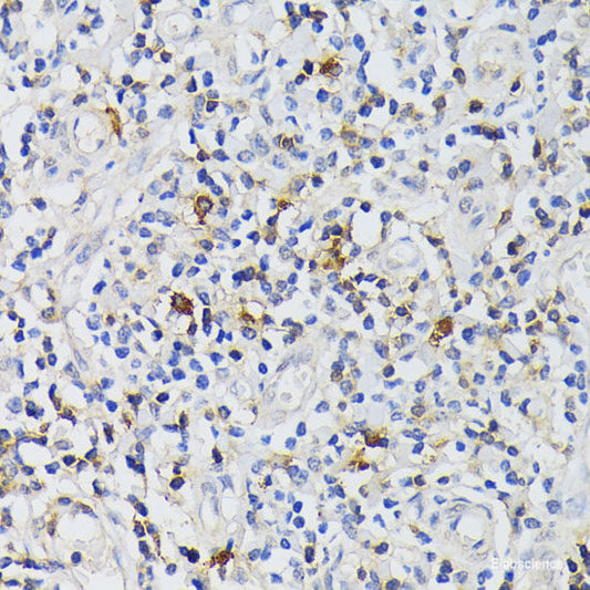 Immunofluorescence analysis of HeLa cells using ACADM Polyclonal Antibody at dilution of  1:100 (40x lens). Blue: DAPI for nuclear staining.