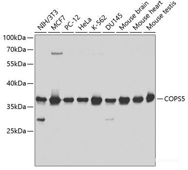 Immunohistochemistry of paraffin-embedded Rat lung using IL9 Polyclonal Antibody at dilution of  1:200 (40x lens).