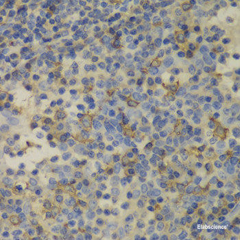 Immunohistochemistry of paraffin-embedded Human liver using CCL21 Polyclonal Antibody at dilution of  1:100 (40x lens).