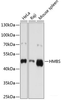 Immunohistochemistry of paraffin-embedded Rat brain using PPP2R4 Polyclonal Antibody at dilution of  1:200 (40x lens).