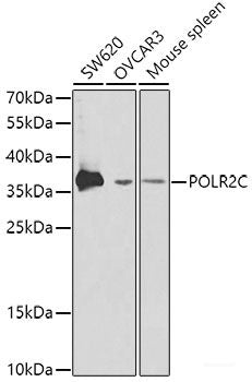 Immunohistochemistry of paraffin-embedded Human normal breast using PKLR Polyclonal Antibody at dilution of  1:200 (40x lens).