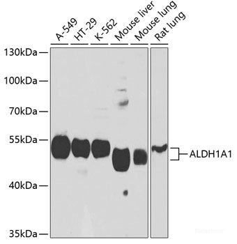 Immunohistochemistry of paraffin-embedded Human colon carcinoma using APBB1 Polyclonal Antibody at dilution of  1:100 (40x lens).
