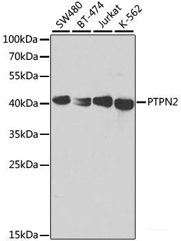 Immunohistochemistry of paraffin-embedded Human lung using SMAD5 Polyclonal Antibody at dilution of  1:100 (40x lens).