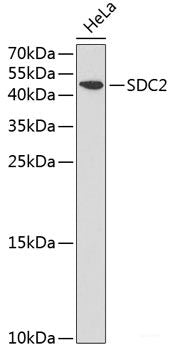 Immunohistochemistry of paraffin-embedded Rat brain using PSMD10 Polyclonal Antibody at dilution of  1:100 (40x lens).