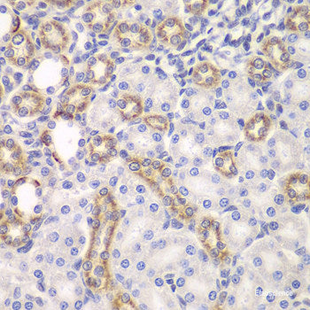 Immunohistochemistry of paraffin-embedded Human liver using CSH1 Polyclonal Antibody at dilution of  1:100 (40x lens).