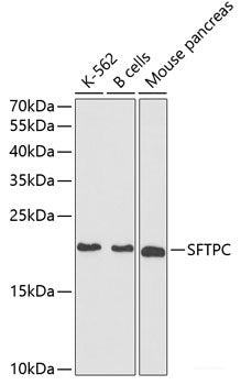 Immunohistochemistry of paraffin-embedded Human tonsil using BMPR1B Polyclonal Antibody at dilution of  1:200 (40x lens).