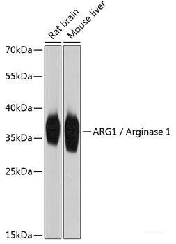 Immunohistochemistry of paraffin-embedded Human normal stomach using CHIT1 Polyclonal Antibody at dilution of  1:200 (40x lens).