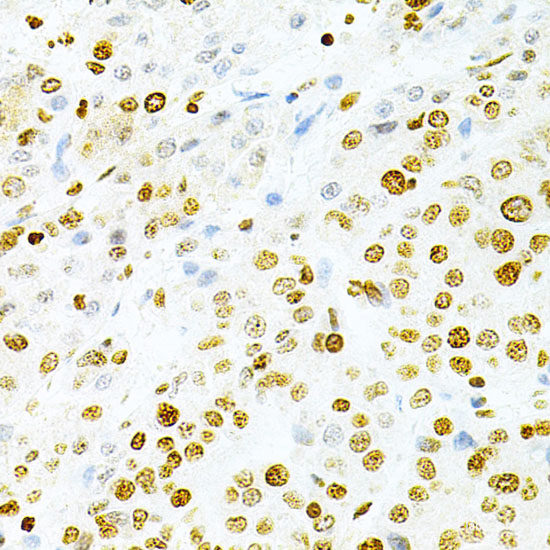 Immunohistochemistry of paraffin-embedded Rat kidney using CD83 Polyclonal Antibody at dilution of  1:200 (40x lens).