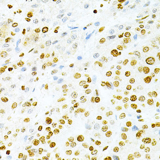 Immunohistochemistry of paraffin-embedded Rat kidney using CD83 Polyclonal Antibody at dilution of  1:200 (40x lens).