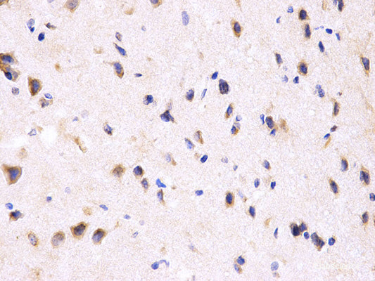 Immunofluorescence analysis of U-2 OS cells using Histone H2AX Polyclonal Antibody at dilution of  1:100 (40x lens). Blue: DAPI for nuclear staining.