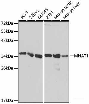 Immunohistochemistry of paraffin-embedded Mouse liver using HNF4A Polyclonal Antibody at dilution of  1:100 (40x lens).