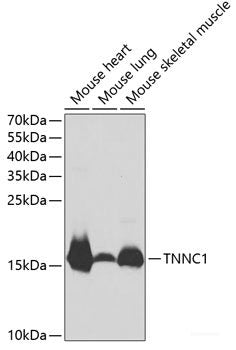 Immunohistochemistry of paraffin-embedded Rat pancreatic islet using INS Polyclonal Antibody at dilution of  1:50 (40x lens).