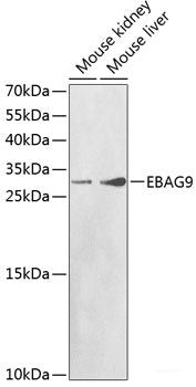 Immunohistochemistry of paraffin-embedded Mouse stomach using NTRK1 Polyclonal Antibody at dilution of  1:100 (40x lens).