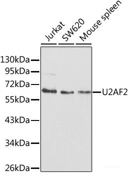 Immunohistochemistry of paraffin-embedded Rat spleen using TNFRSF11B Polyclonal Antibody at dilution of  1:200 (40x lens).