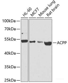 Immunohistochemistry of paraffin-embedded Rat lung using REG3A Polyclonal Antibody at dilution of  1:100 (40x lens).