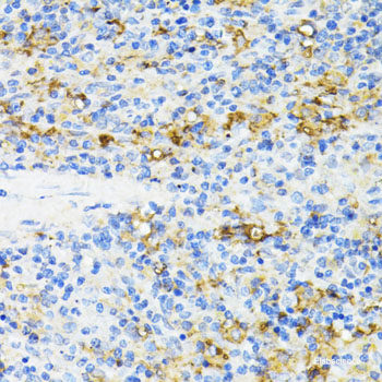 Immunohistochemistry of paraffin-embedded Rat spleen using PRKCE Polyclonal Antibody at dilution of  1:200 (40x lens).