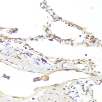 Immunohistochemistry of paraffin-embedded Rat brain using PTEN Polyclonal Antibody at dilution of  1:200 (40x lens).