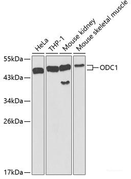 Immunohistochemistry of paraffin-embedded Human esophagus using FAK Polyclonal Antibody at dilution of  1:100 (40x lens).