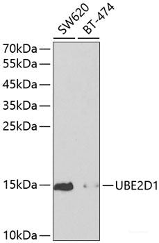 Immunofluorescence analysis of Y79 cells using Rb Polyclonal Antibody at dilution of  1:100. Blue: DAPI for nuclear staining.
