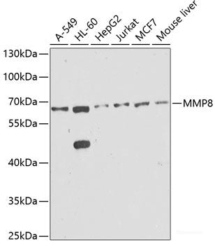 Immunofluorescence analysis of Mouse brain cells using THY1 Polyclonal Antibody at dilution of  1:100. Blue: DAPI for nuclear staining.